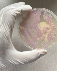 Plaatje van de Candida albicans Plaatje van de Candida albicans