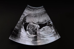 Echo van ongeboren kind