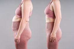 Voor en na het afvallen met GLP-1