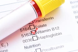 B12 bloedtest B12 bloedtest