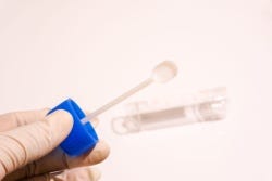 Bakje voor een ontlasting onderzoek Bakje voor een ontlasting onderzoek